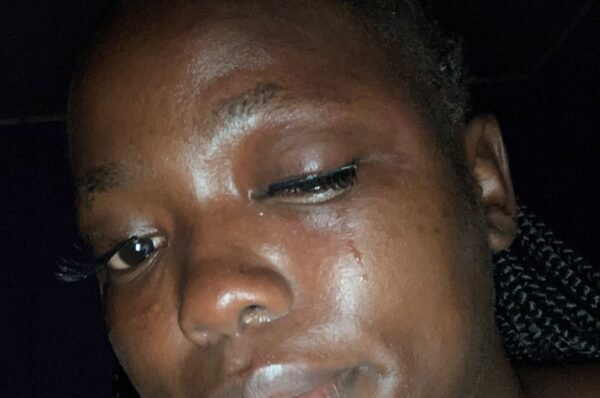 Abibatu Kargbo’s Life in Danger